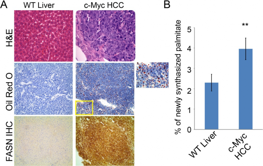 Figure 3: Increased lipogenesis in c-Myc induced mouse HCC